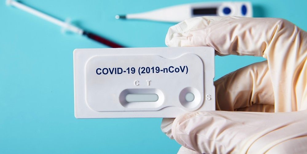 В Югру поступит несколько тысяч тестов на COVID-19