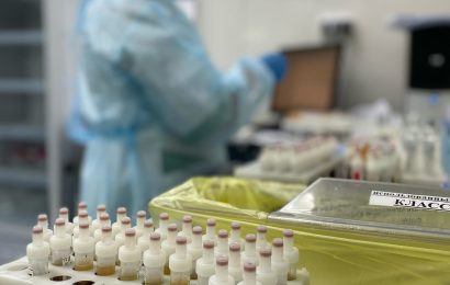 В Югре снизилось число выявляемых случаев ВИЧ В Югре снизилось число выявляемых случаев ВИЧ